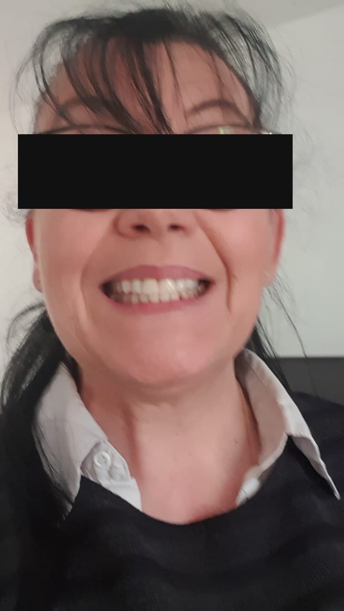 La patiente après le traitement, les yeux masqués